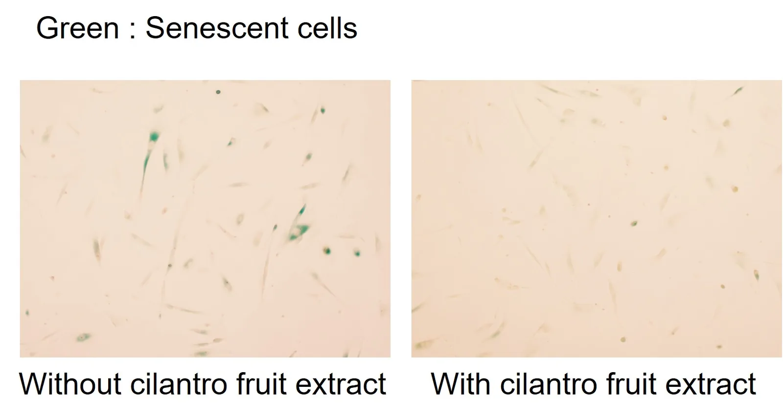Micrografías de Shiseido: células senescentes de la piel teñidas de verde, sin y con extracto de cilantro